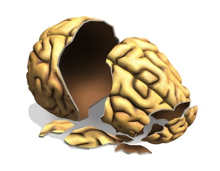 Long Term Impacts of Traumatic Brain Injuries