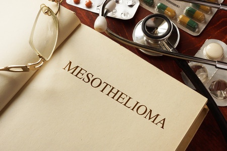 What is Mesothelioma?