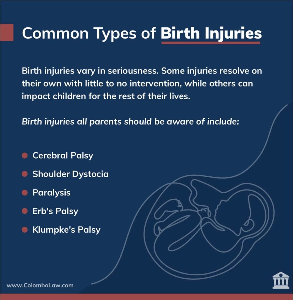 What Are the Most Common Types of Birth Injury? | Colombo Law
