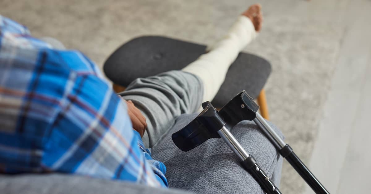 Injured person propping broken leg on chair | Colombo Law