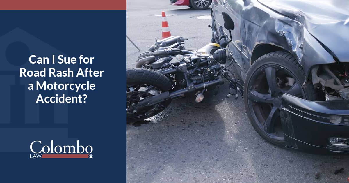 Road Rash Injutry Road Rash After a Motorcycle Accident: Can You Sue in WV?